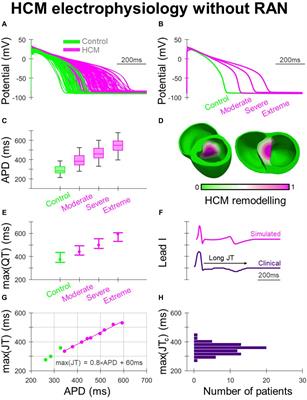 Effects of ranolazine on the arrhythmic substrate in hypertrophic cardiomyopathy